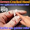 Органическая травяная сыворотка для сухих и потрескавшихся рук и ног - Мягкое восстановление