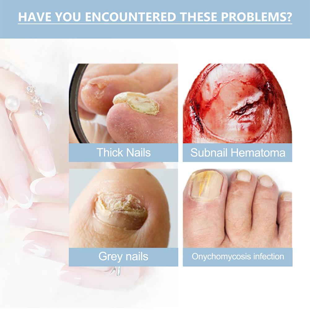 15 мл сыворотка для укрепления ногтей жидкость для восстановления ногтей для восстановления и укрепления ногтей