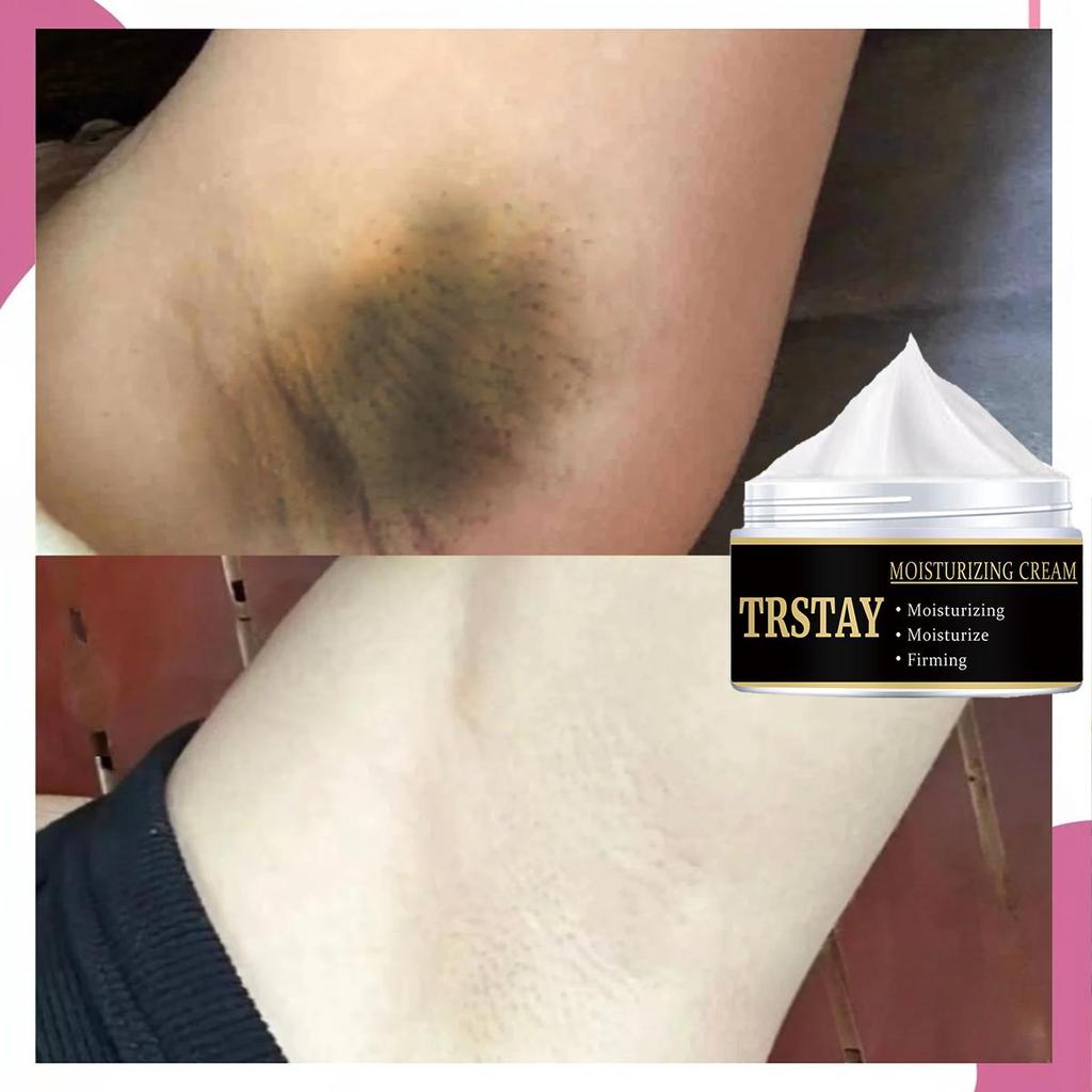 Мягкая формула крема для депиляции эффективно удаляет волосы, питает кожу, восполняет ее влагу, питает увлажняющий крем