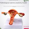 Large Female Reproductive Anatomy Model for Teaching and Family Planning