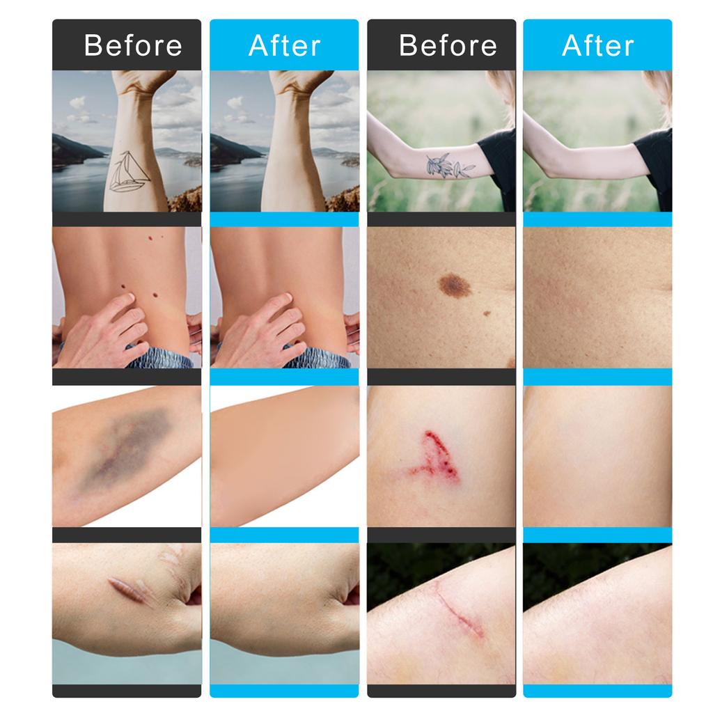 6 листов водонепроницаемой маскирующей ленты для кожи, наклейки для маскировки татуированных изъянов, наклейки для маскировки изъянов шрамов для свадеб