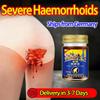 Powerful Hemorrhoid Cream, Relieving Swelling and Bleeding, Root Repair