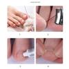 Ingrown Toenail Corrector Tools Pedicure Recover Embed Toe Nail Treatment Professional Ingrown Toenail Correction Foot Care