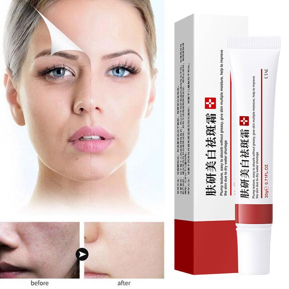 Крем для удаления прыщей, крем от веснушек, сужающий поры, отбеливающий, увлажняющий, контроль жирности, крем от прыщей, уход за кожей, лечение прыщей, крем для лица