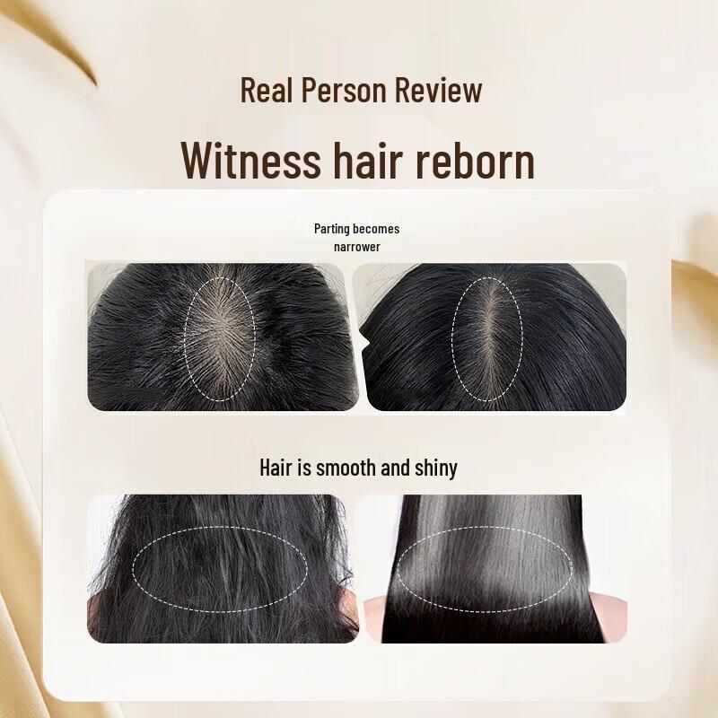 BaWang Anti-Hair Loss & Oil Control Shampoo