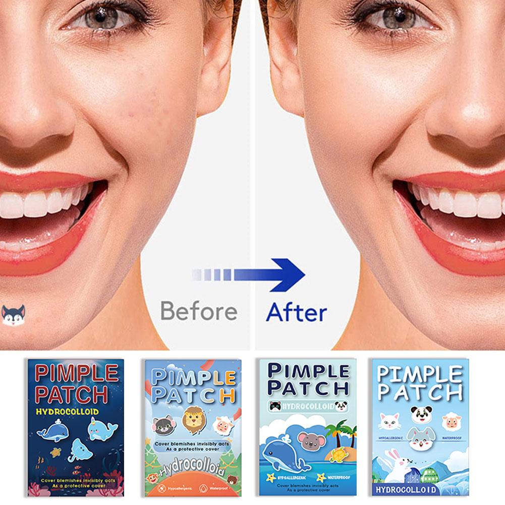 600Pcs Animal Shaped Acne Dark Dots Patches High-end Pimple Acne Cover Facial Acne Treatment Stickers Zits Blemishes Patches