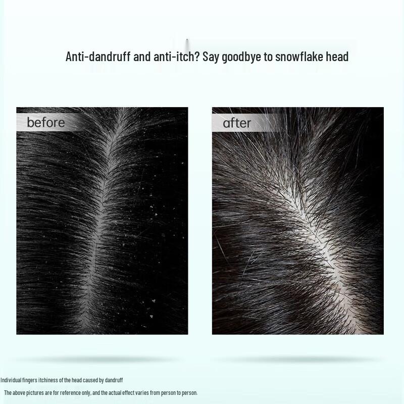 Ziyuan Camellia Seed Oil Control Anti-Dandruff Shampoo