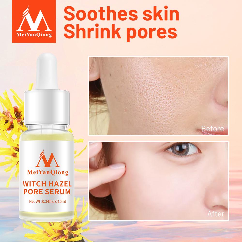 Отбеливающая эссенция для сужения пор с экстрактом гамемелиса 10мл