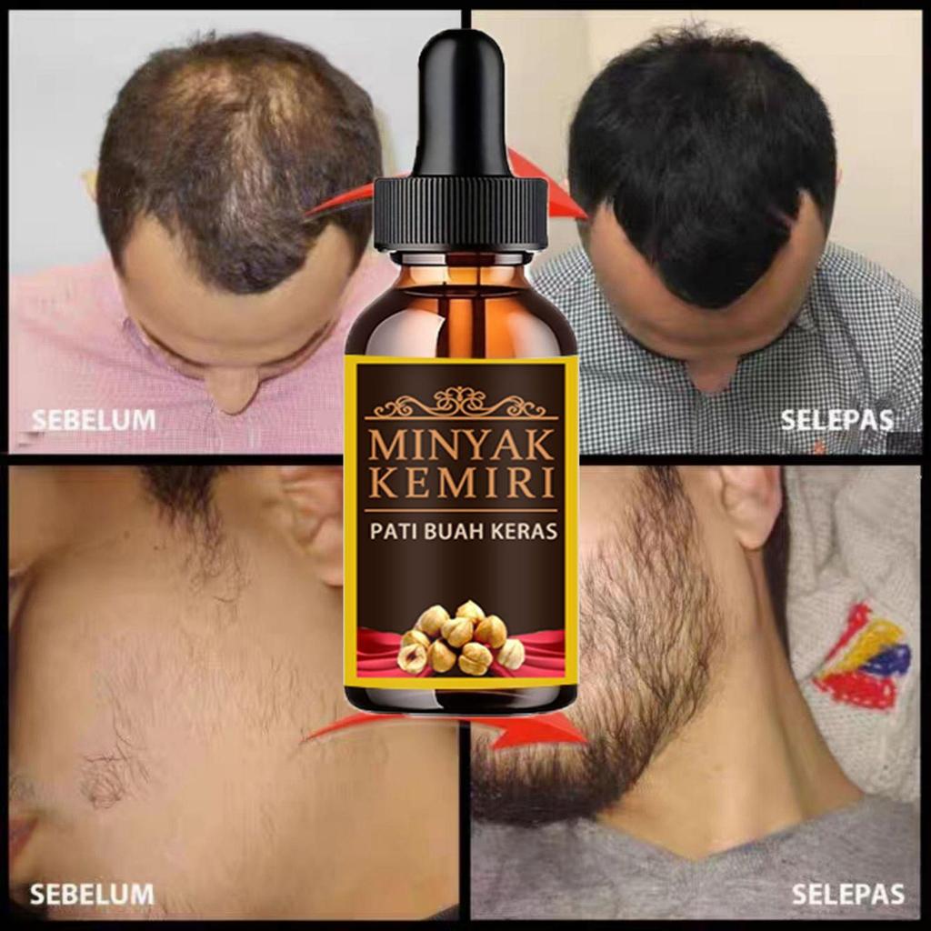 TRSTAY Beard Growth Essence Oil Essential Oils Liquid Hair Grower Oil Hair Maintenance Beard Chest Hair Growth Solution