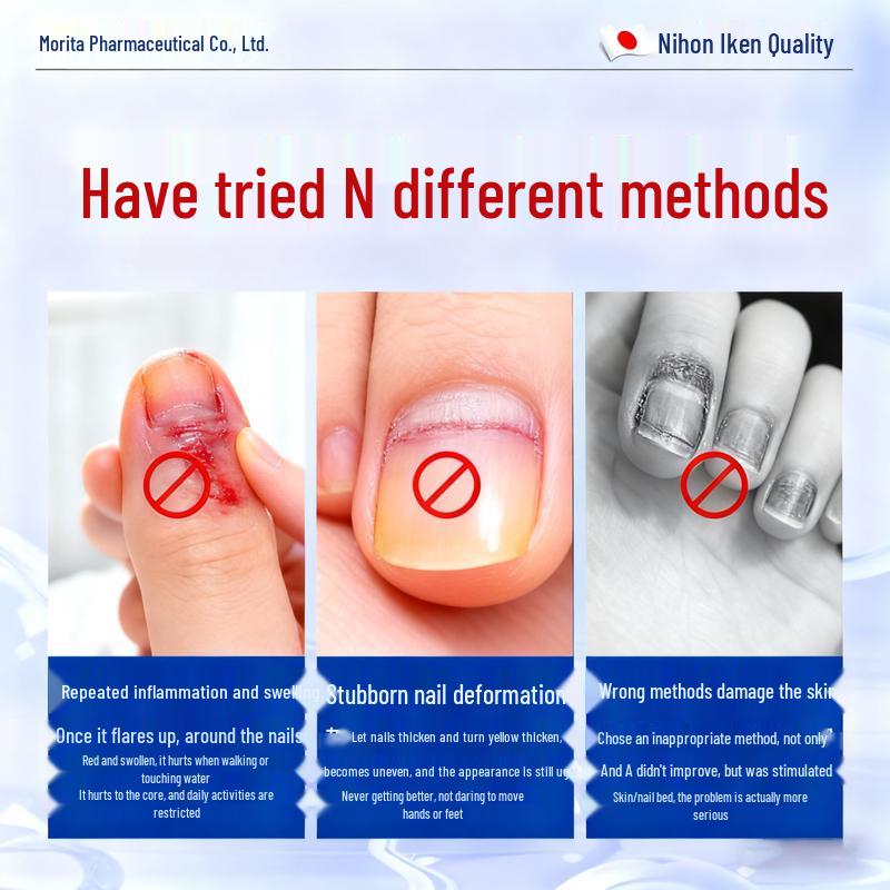 Que Yi Shi Jia Antifungal Nail Repair Solution