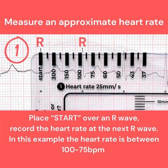 Прозрачная 7-ступенчатая линейка, измерительный инструмент, компактный дизайн, портативный карманный справочник для интерпретации ЭКГ, инструмент для оценки