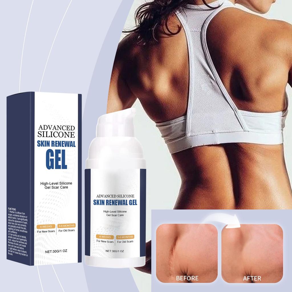 Улучшенный силиконовый гель для кожи, нежное увлажнение и осветление растяжек, осветление тонких линий и удаление геля для разглаживания кожи, 30 г