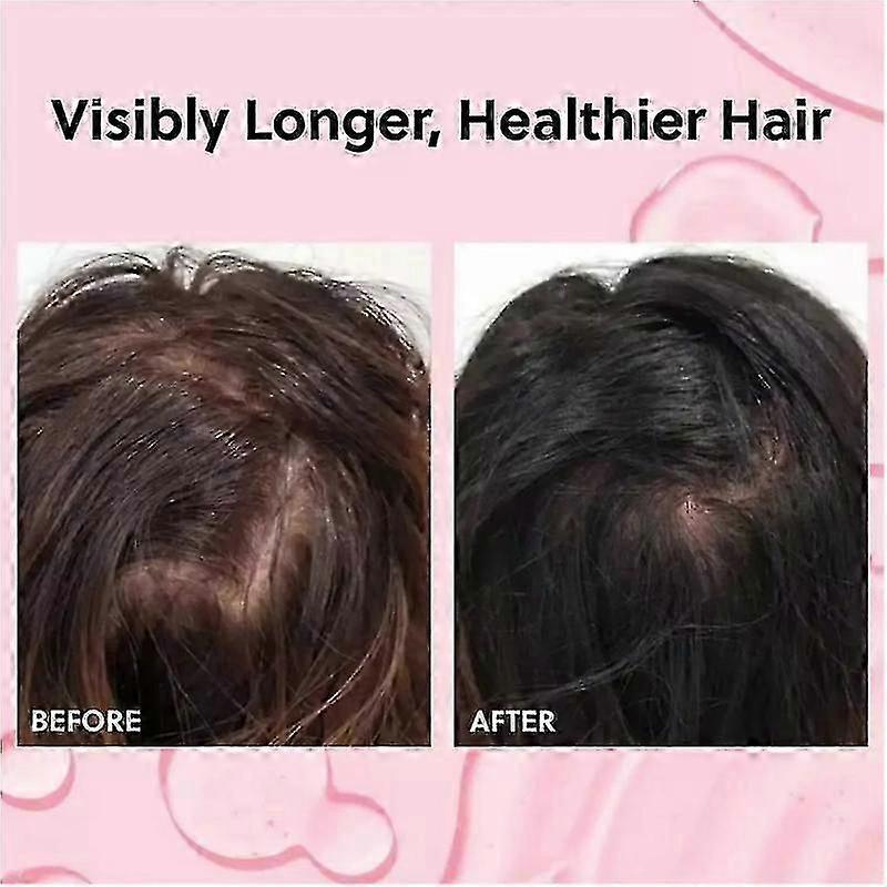 25-26 Advanced Hair Growth Oil Spray -Non-Greasy Hormone Free Formula - Promotes Thick