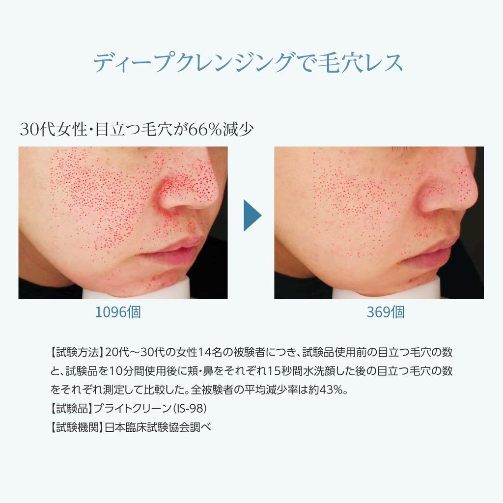 Парогенератор Bright Clean Facial Device Парогенератор Beauty Pore Care YJSA0B Black YA-MAN