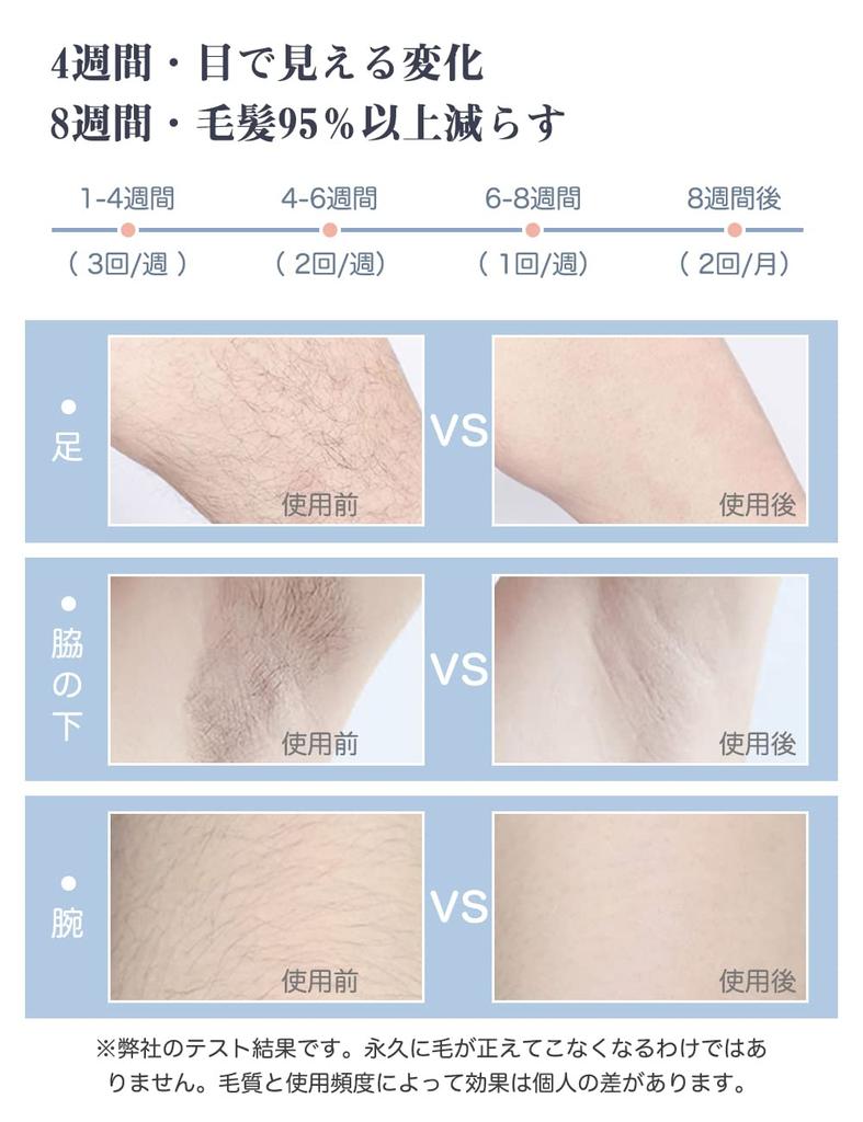 Cydtion Hair Removal Device Light Hair Removal Cooling Epilator for and Full 5 Levels of Home Hair Removal Device for Men and Women [2023 Salon-Grade