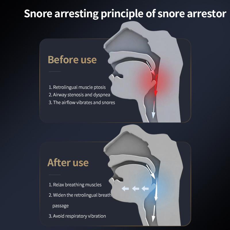 Электрическое устройство против храпа Электрическое устройство для остановки храпа Устройство для беспрепятственного сна с носовыми отверстиями Интеллектуальное устройство для коррекции храпа