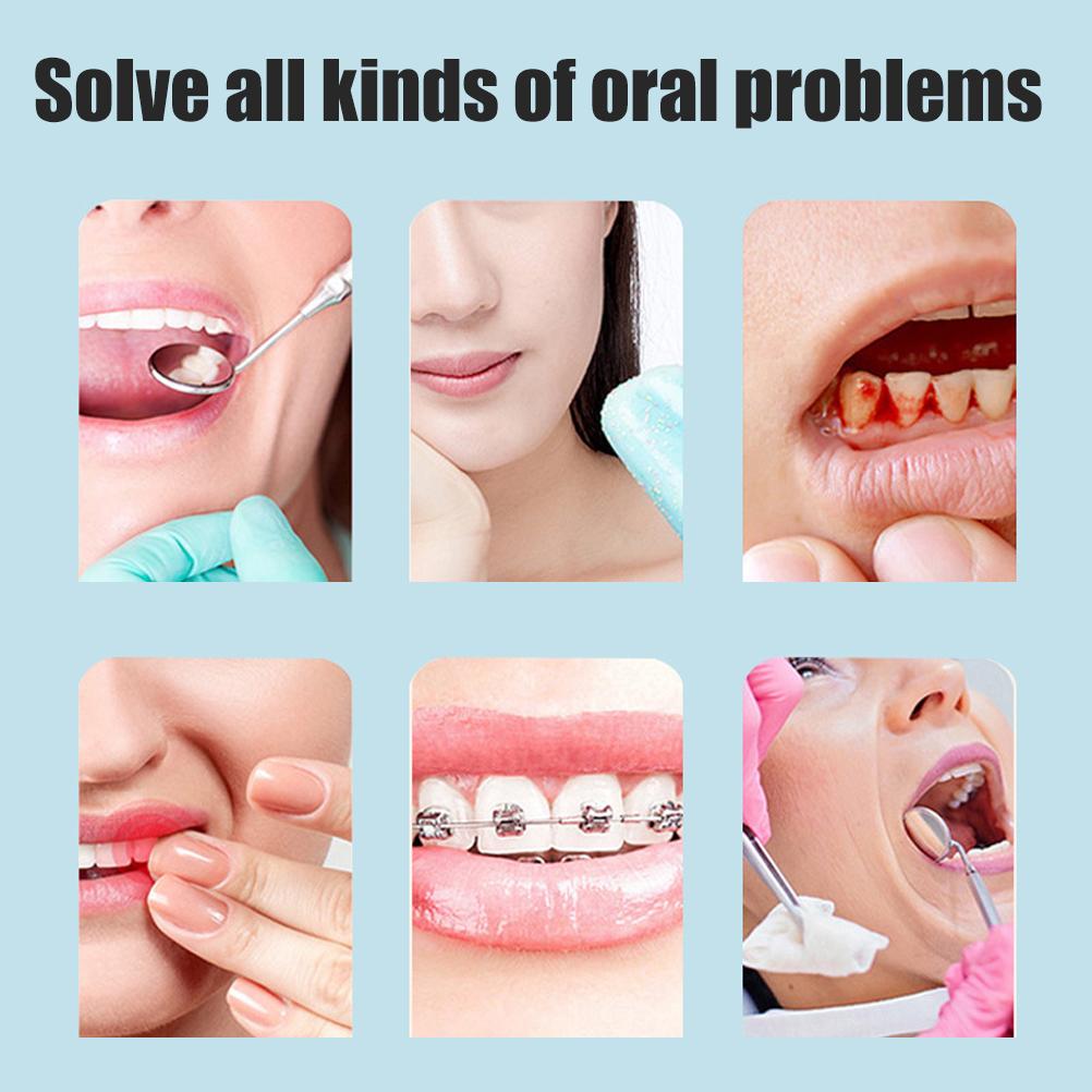 Oral Irrigator Water Pick Teeth Cleaner Water Flosser Portable Manual Dental Scaler for Travel