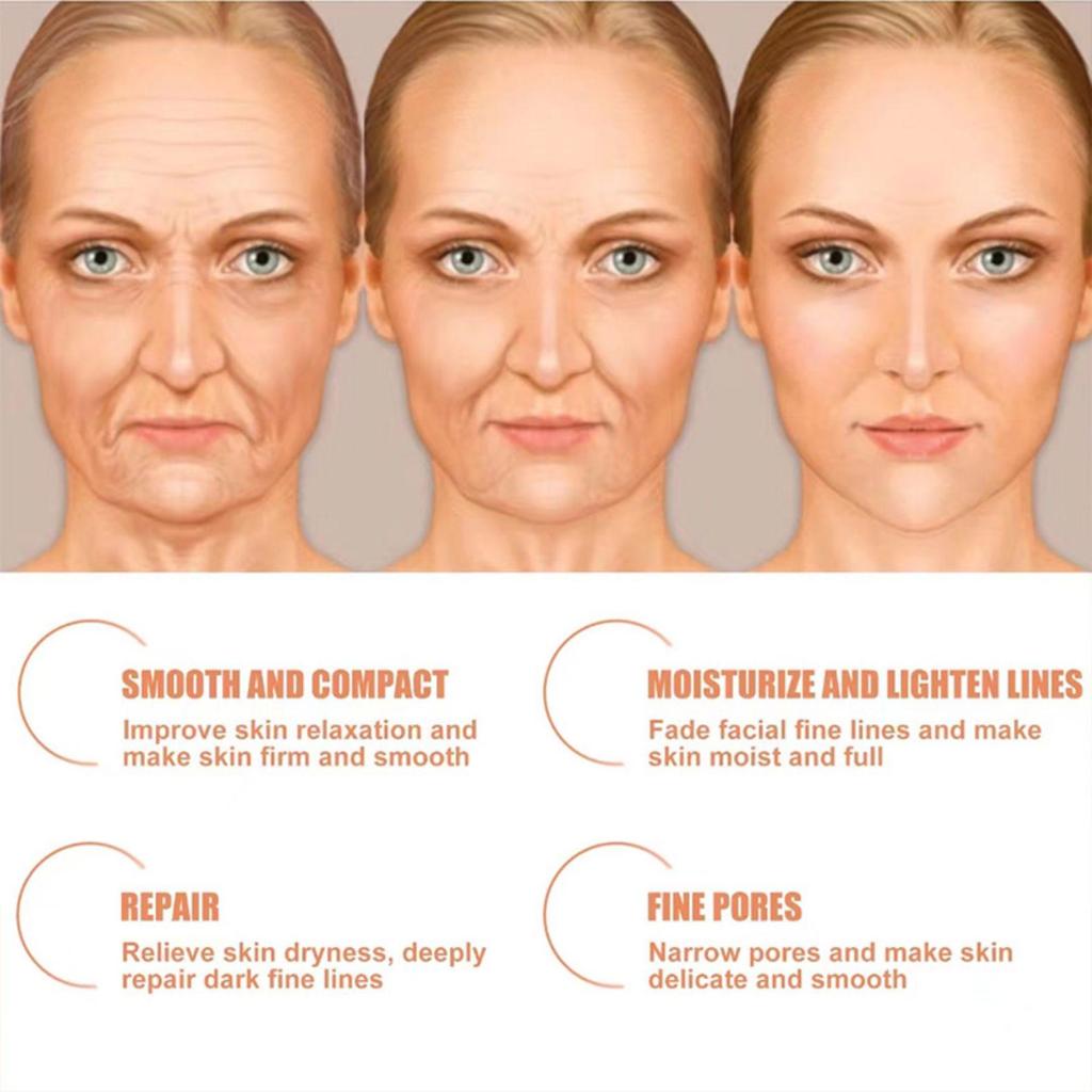 5G/15G/30G/50G/Lighten Dark Circles, Shrink Pores, Improve Skin Texture, Bid Farewell To Fine Lines, Supplement Moisture, Tighten Skin Face Cream