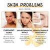 Limited time!!Eelhoe Vitamin C Facial Serum - Gently Hydrates, Moisturizes, Firms Skin, Reduces Fine Lines, And Brightens Complexion