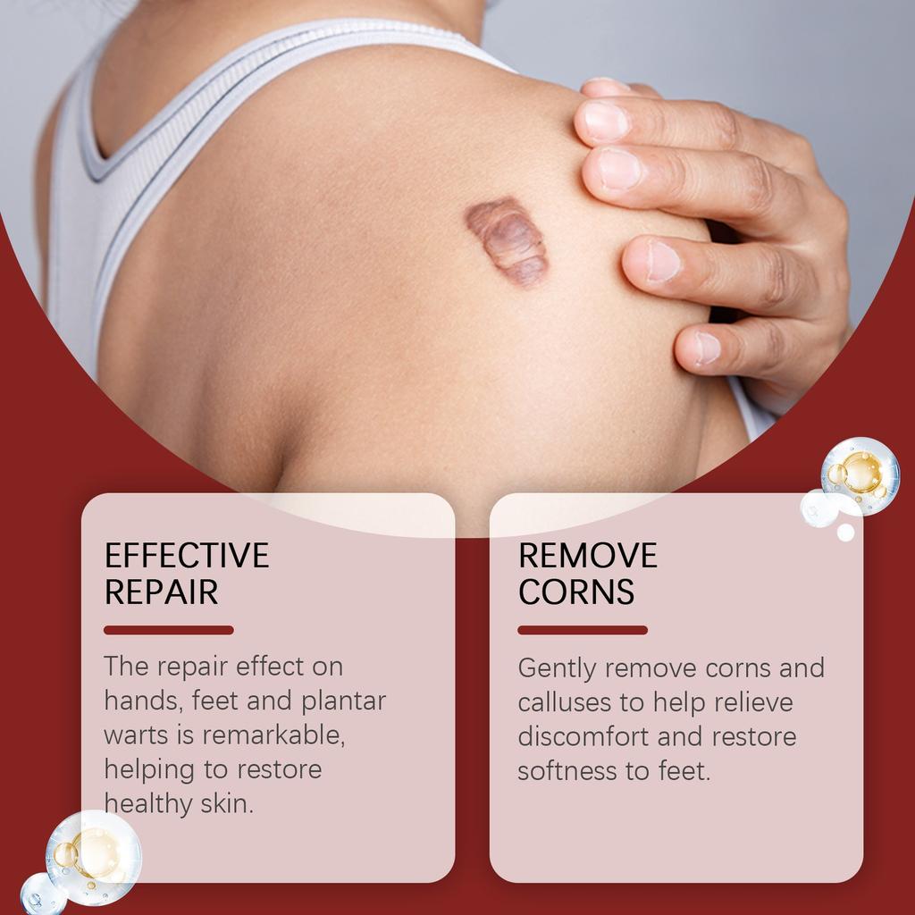 Пластырь для удаления пчел и родинок Пластырь для ухода за кожей Мягкий состав Коллаген Ежедневный уход за кожей