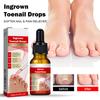 10ml Nail Care Concentrates Recover Hands And Feet Yellow Thickening Gray Nail Rot Moisturizing Treating