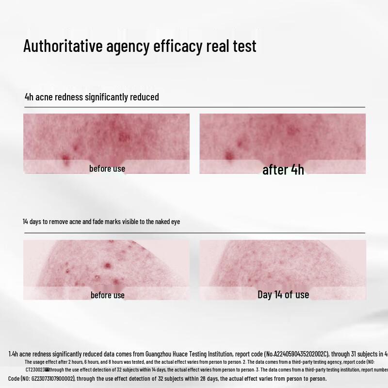 Крем-эссенция от акне Hiruscar с азелаиновой кислотой
