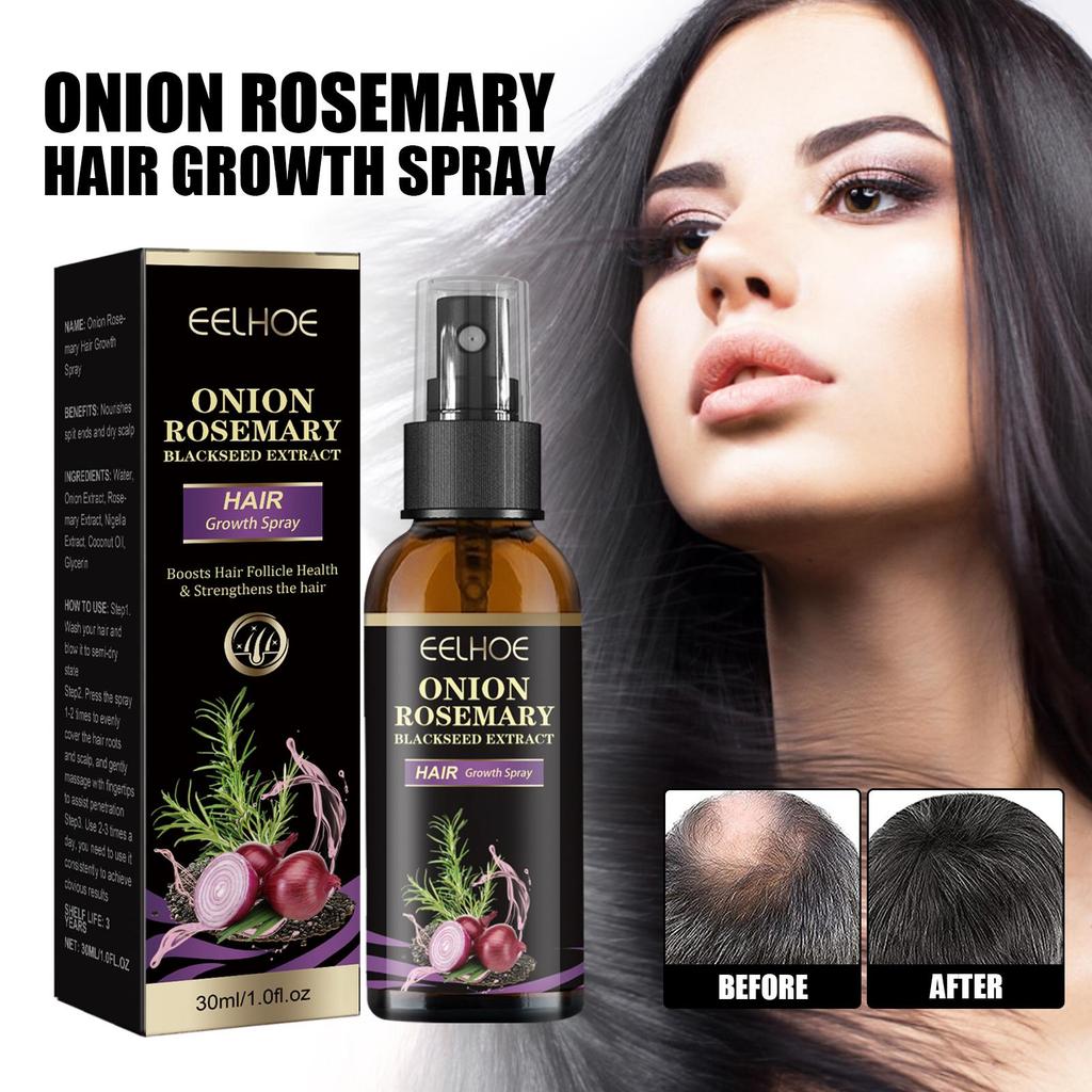 EELHOE Спрей для волос с луком и розмарином, глубоко увлажняющий кожу головы, разглаживающий и блестящий спрей-кондиционер для волос