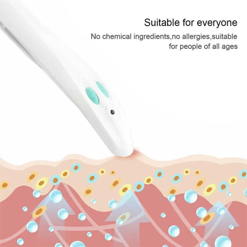 Electronic Mosquito Bite Pen Antipruritic Device Portable Antipruritic Pen Anti-itch Physical Itch Stick Stop Pen for Outdoor