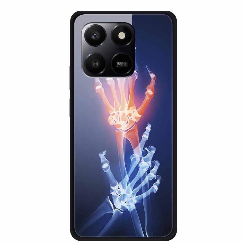 Glass Case For Honor X7d Play 10T 5G Case Soft Bumper Hard Tempered Glass Back Cover For Honor 400 Smart 2025 Phone Cases Fundas