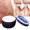 88g Anti Crack Moisturizing Hand Foot Cream Repairing Fissures Heal Ointment