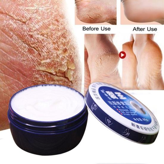 88g Anti Crack Moisturizing Hand Foot Cream Repairing Fissures Heal Ointment
