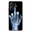 Для Redmi Note 14 4G ГЛОБАЛЬНЫЙ Чехол Животные Мягкий Силиконовый ТПУ Чехлы для Телефона Задняя Крышка для Xiaomi Redmi Note14 4G Защитник Coque