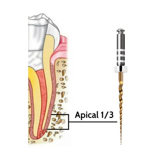 Waldent Ротационные файлы для ретритмента