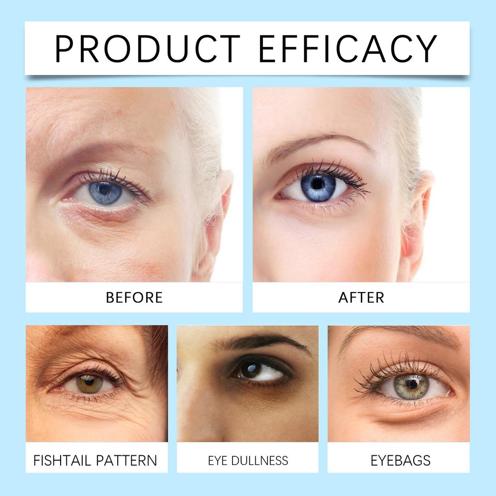 Увлажняющая и питательная маска для глаз с церамидами и ретинолом, осветляющая морщины под глазами, темные круги, осветляющая тонкие линии под глазами, 2 мл