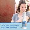 Heat Rash Spray, Quick Relief Of Itching 30ml