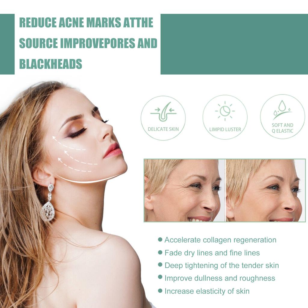 Экстракт ретинола, омолаживающее средство для сужения пор, разглаживает мелкие морщины, осветляет, укрепляет и освежает кожу лица