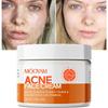 100g Acne Removal Quickly Oil Control Suitable for Women Pimple Treatment