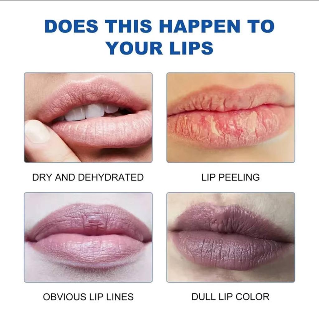 Бальзам для губ Dull Removing, быстро осветляющий губы, отшелушивающий крем, осветляющий морщины на губах, увлажняющий крем для омертвевшей кожи.