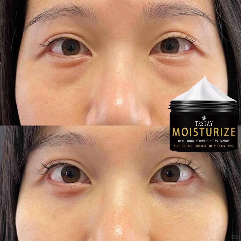 Caffeine Eye Cream for Anti Aging, Dark Circles Bags Puffiness Great Under Eye Skin + Face Tightening