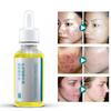 Whitening Face Cream, Whitening Cream, Facial Skin Moisturizing Brightening Cream,Natural Herbal Extract 30ml