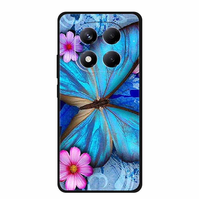 For Xiaomi Redmi Note 15 Pro / Note 15 Pro+ 5G Case Global Version 25060RABDG 2510ERA8BG Luxury Soft Silicone Back Cover Cases