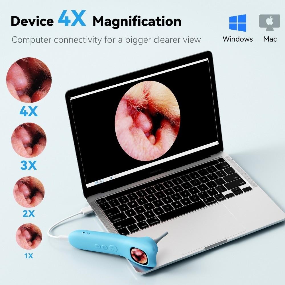 1.21 Inch IPS Screen Ear Camera 1080P HD Digital Ear Camera Durable Visual Ear Care Ear Care