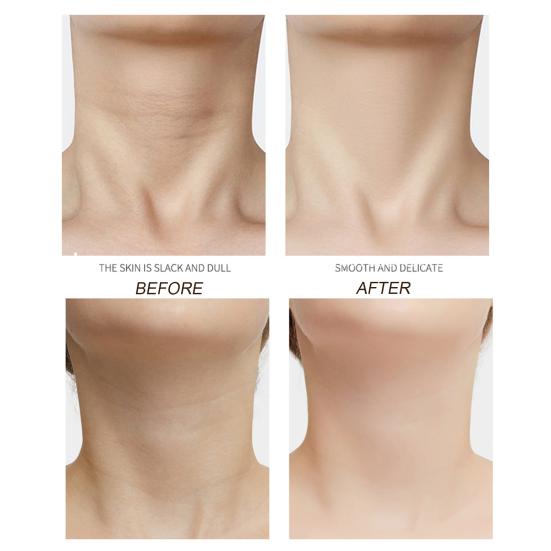 5 шт. патчи против морщин для шеи, увлажняющие укрепляющие патчи для шеи, разглаживающие коллагеновые подушечки для шеи, питательная пленка для шеи с камелией