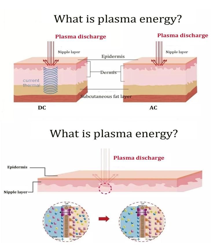 Professional Ozone Plasma Pen Machine for Alleviating Skin Aging Skin Rejuvenation Whitening Acne Treatment Plasma Pen