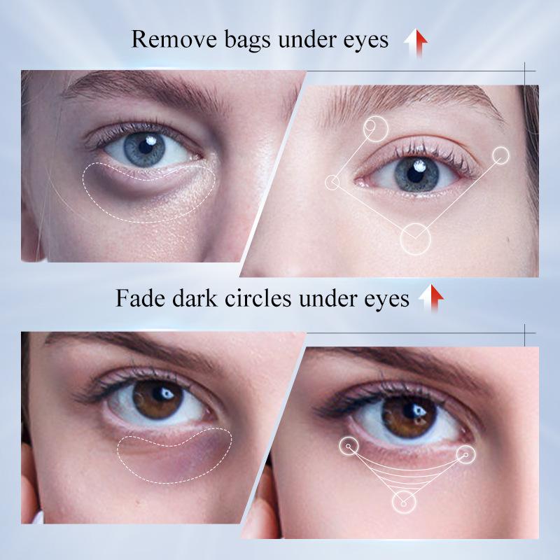 Крем для глаз для удаления жировиков, разглаживающий мелкие морщины, уменьшающий темные круги, восстанавливающий барьер, против отечности, противовоспалительный крем