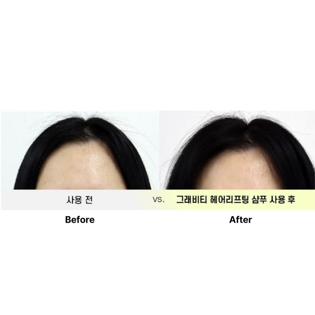 [grabity] Hair Lifting Shampoo Extra Strong  475ml (Hair loss care)