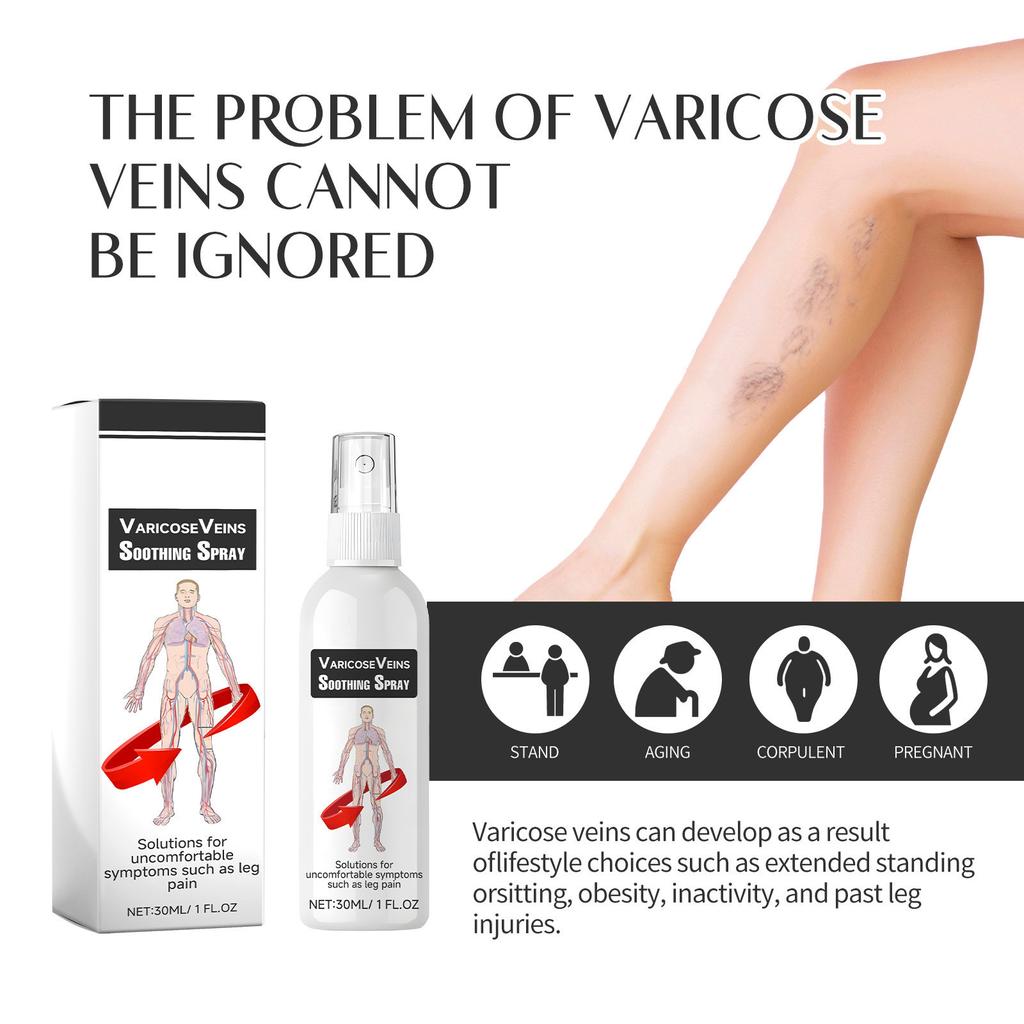 Спрей для варикозного расширения вен, Спрей для варикозного расширения вен, Спрей для варикозного расширения вен 30мл