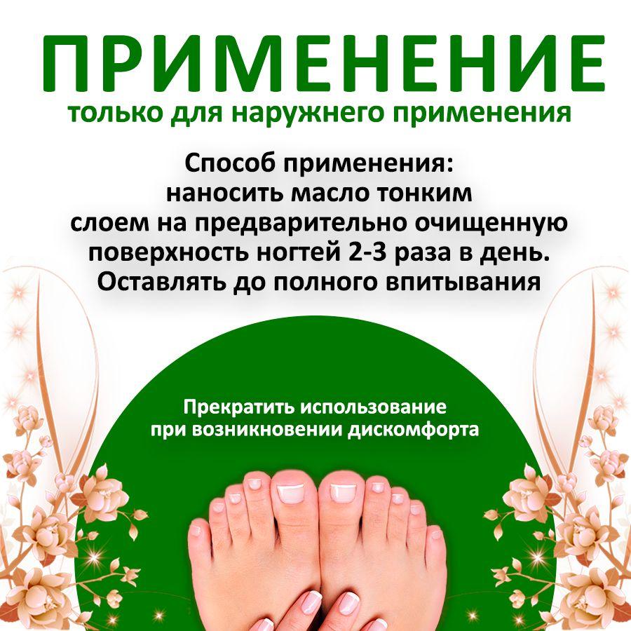 5 мл Масло для снятия лака при онихомикозе