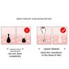 Electric LCD Blackhead Remover Vacuum Suction Acne Pore Cleaner Skin Facial Clean Care Machine With 6 Suction Heads