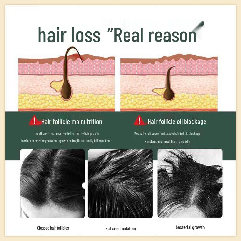 Тонирун Шампунь для роста волос и ухода за черными волосами на травах